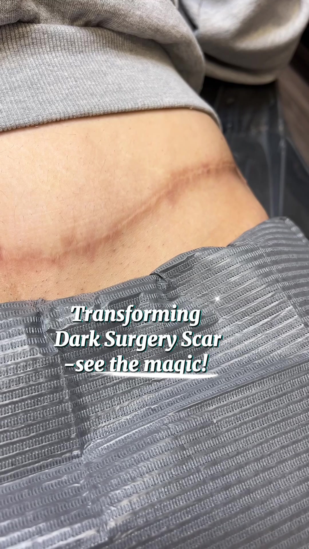 @Invisibleskinhelp
