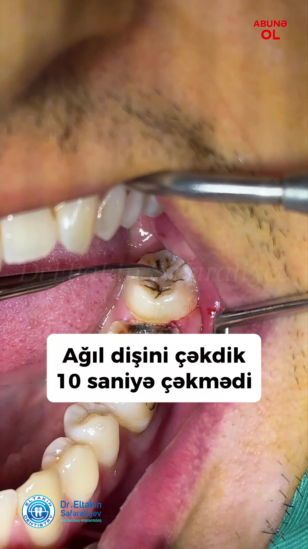 @eltakindentistry