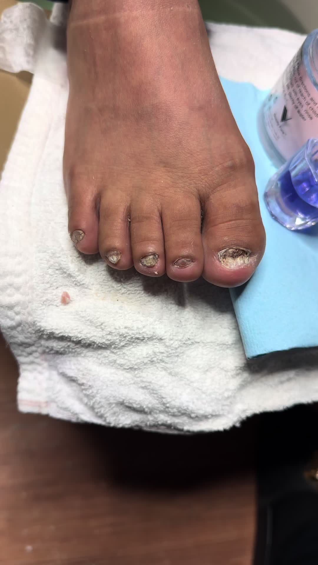 @ToesbyKoki