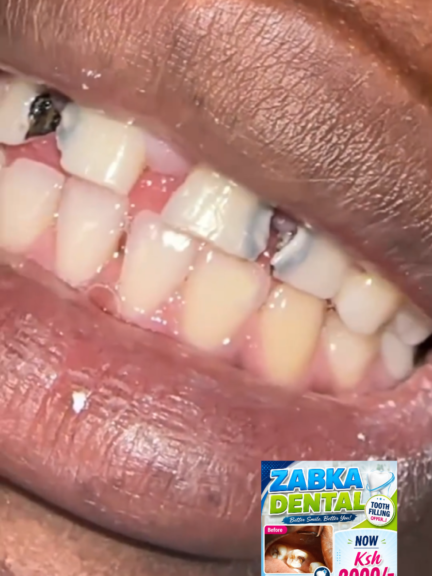 @Zabka Dental