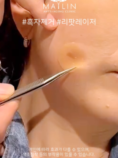 @메이린의원대구점