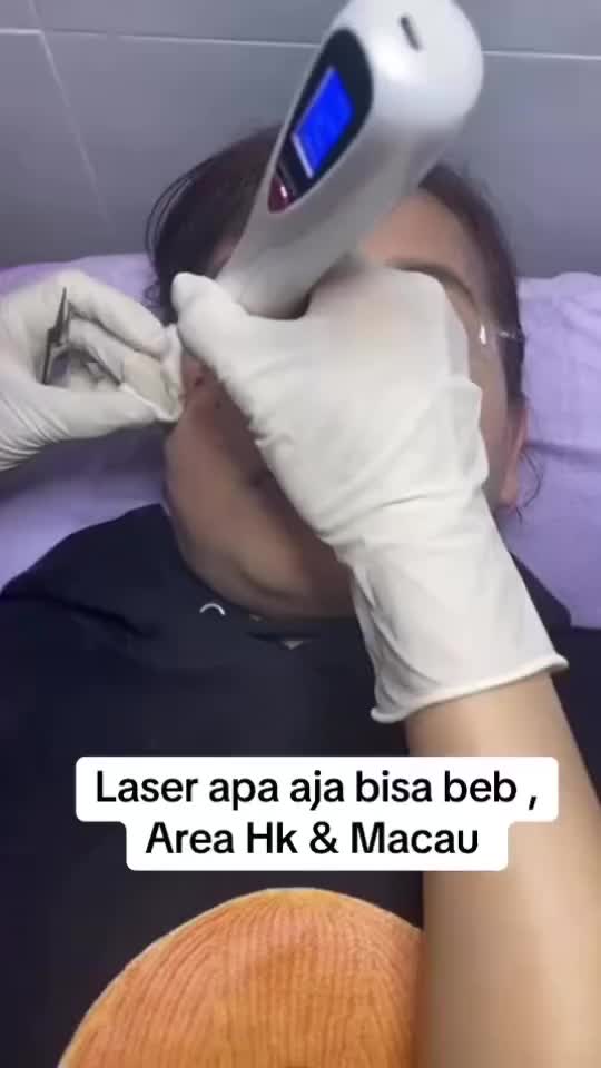 @Ubi ungu