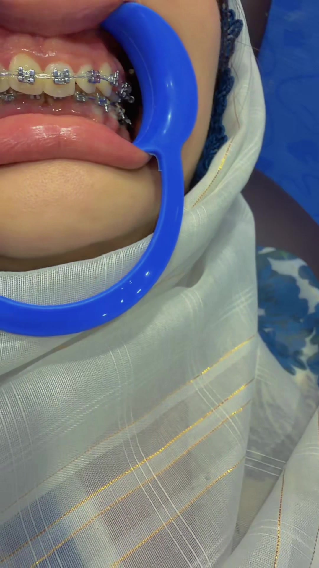 @Dr__Anmoll🦋🦷