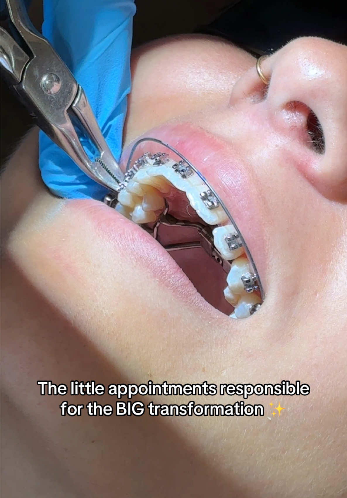 @Woodland Hills Orthodontist