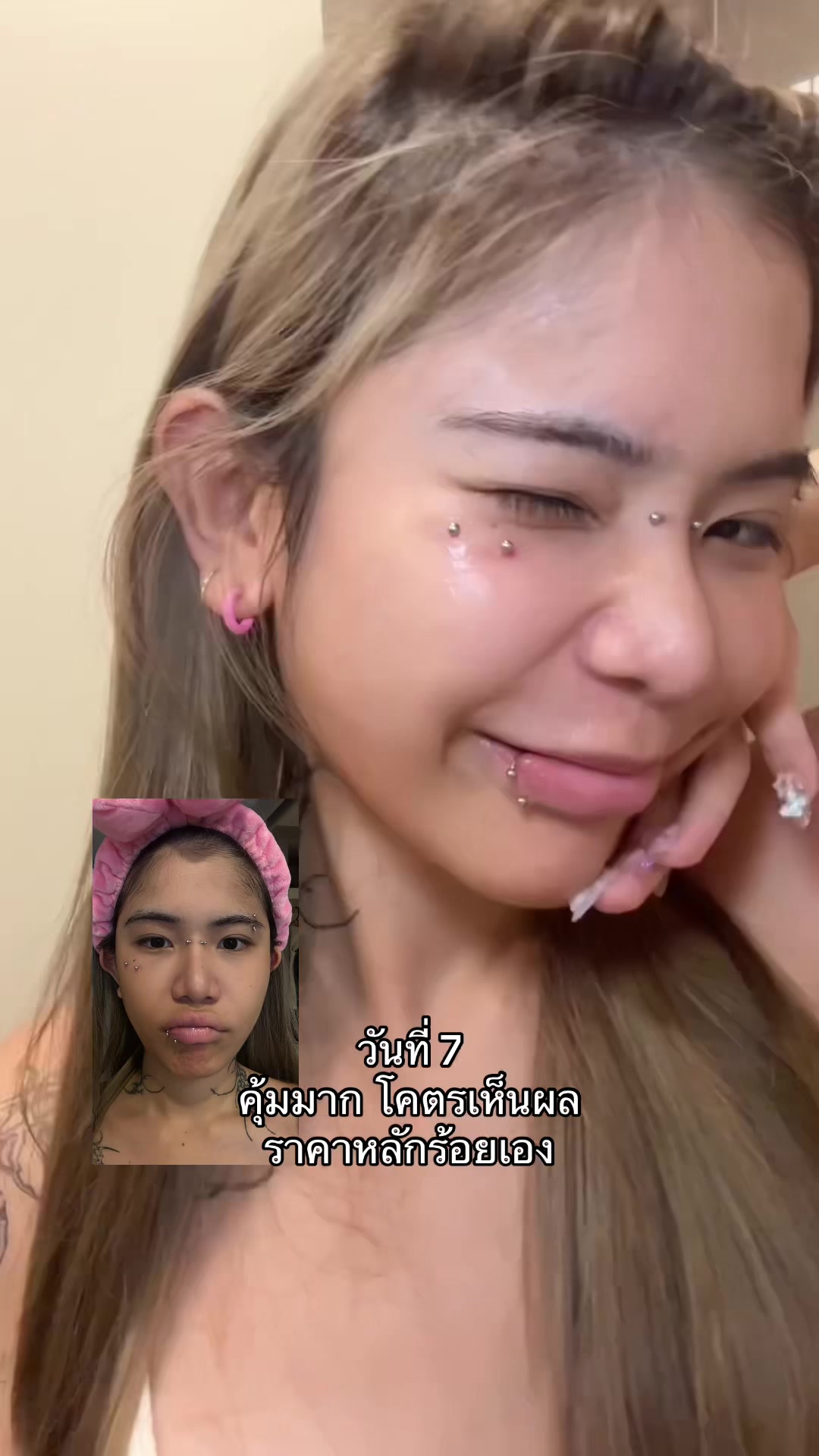 @หนูทิ้น