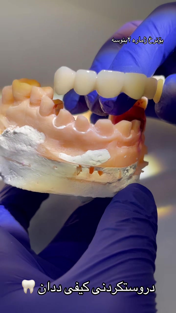 @🦷 دکتۆرە ئیمان کاکەمەم