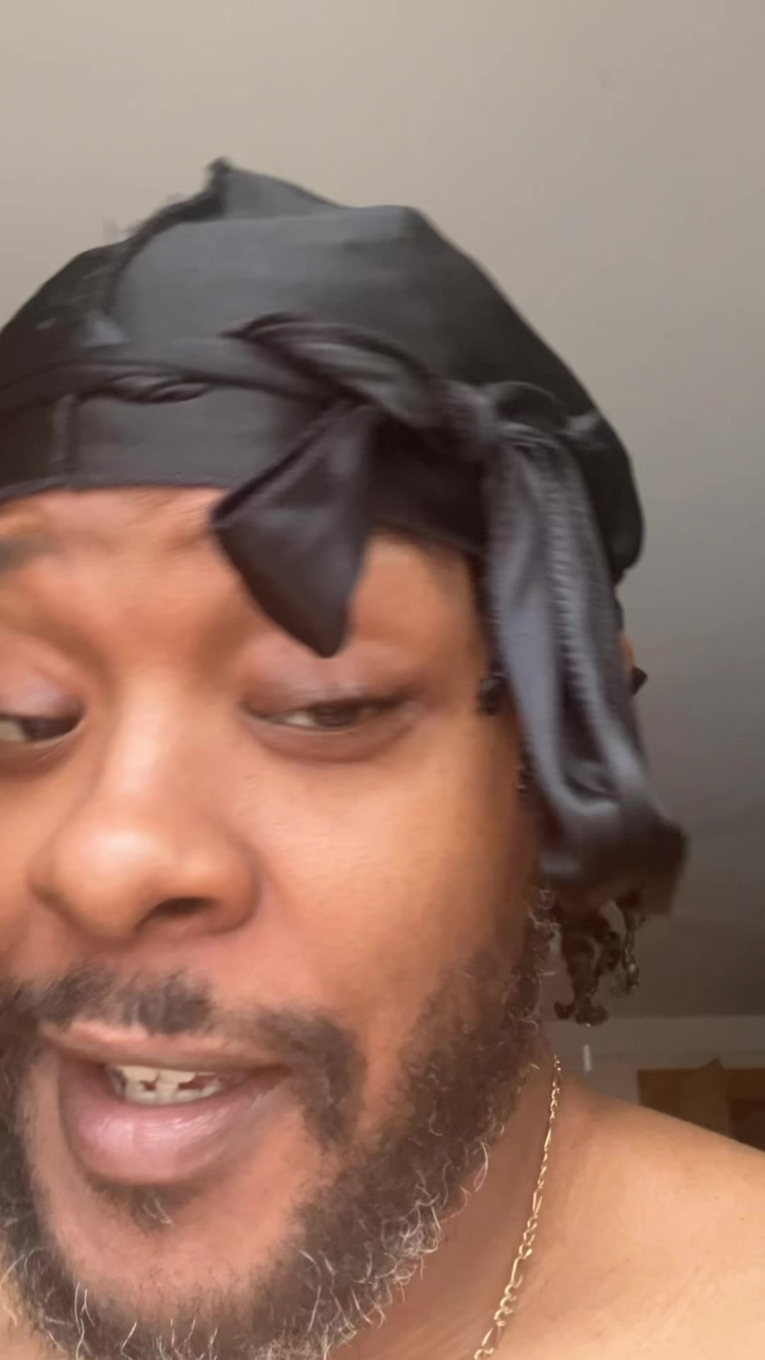 @Skalla Vision