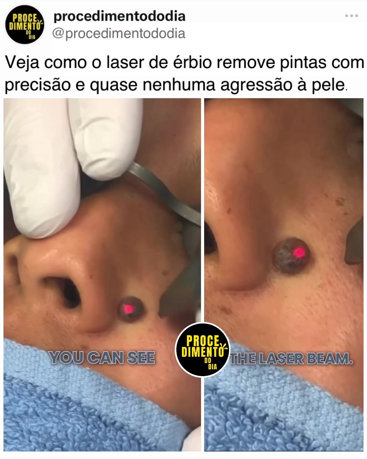 @procedimentododia