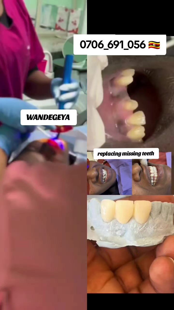 @Dental studio.🦷.Kampala