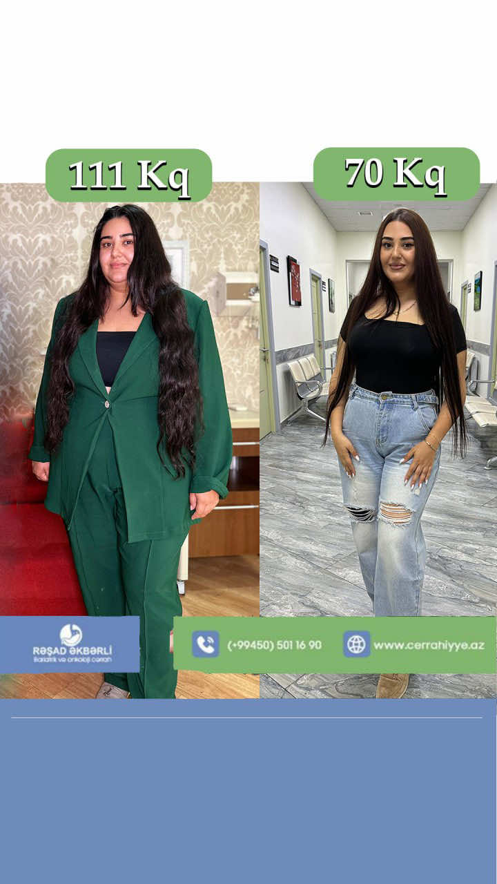 @&Uuml;mumi Cərrah Rəşad Əkbərli