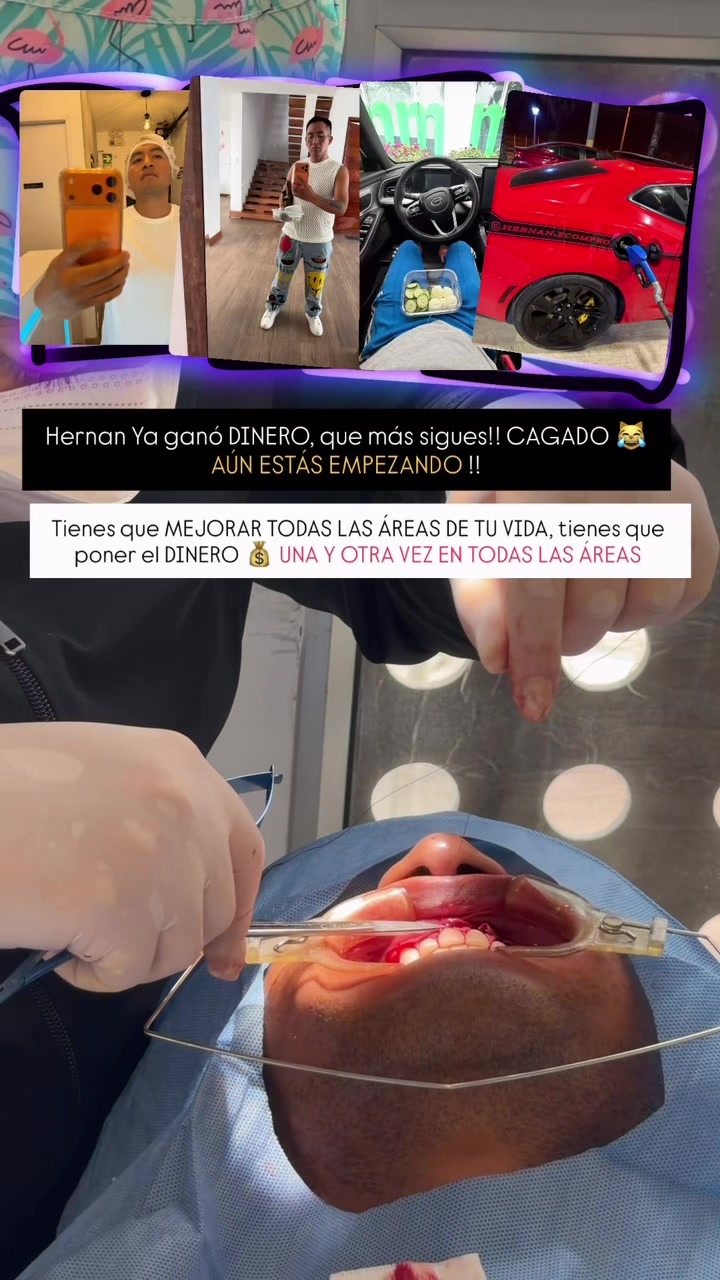 @Hernan Flores