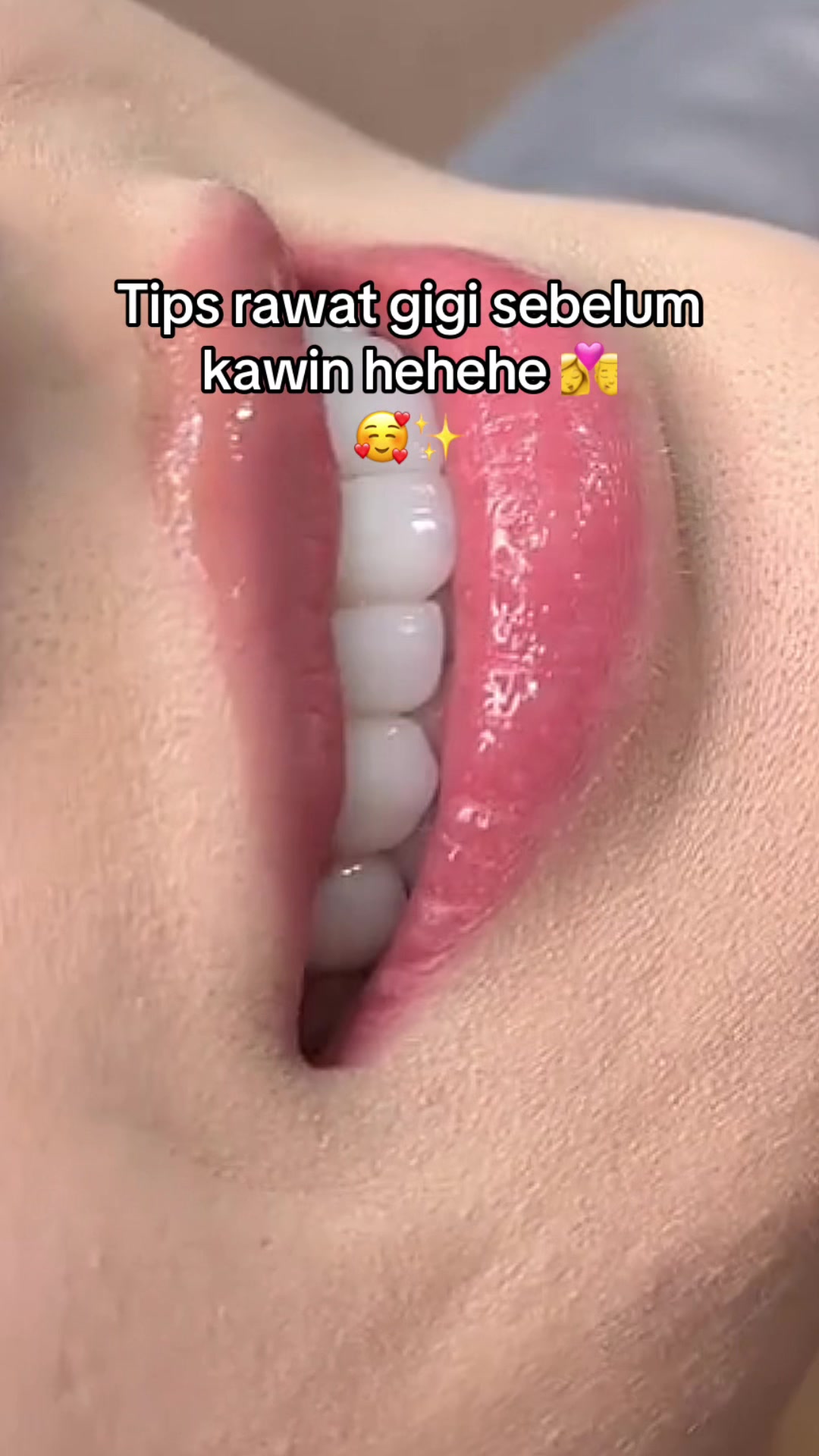 @Gigi Putih Berkilau🦷✨