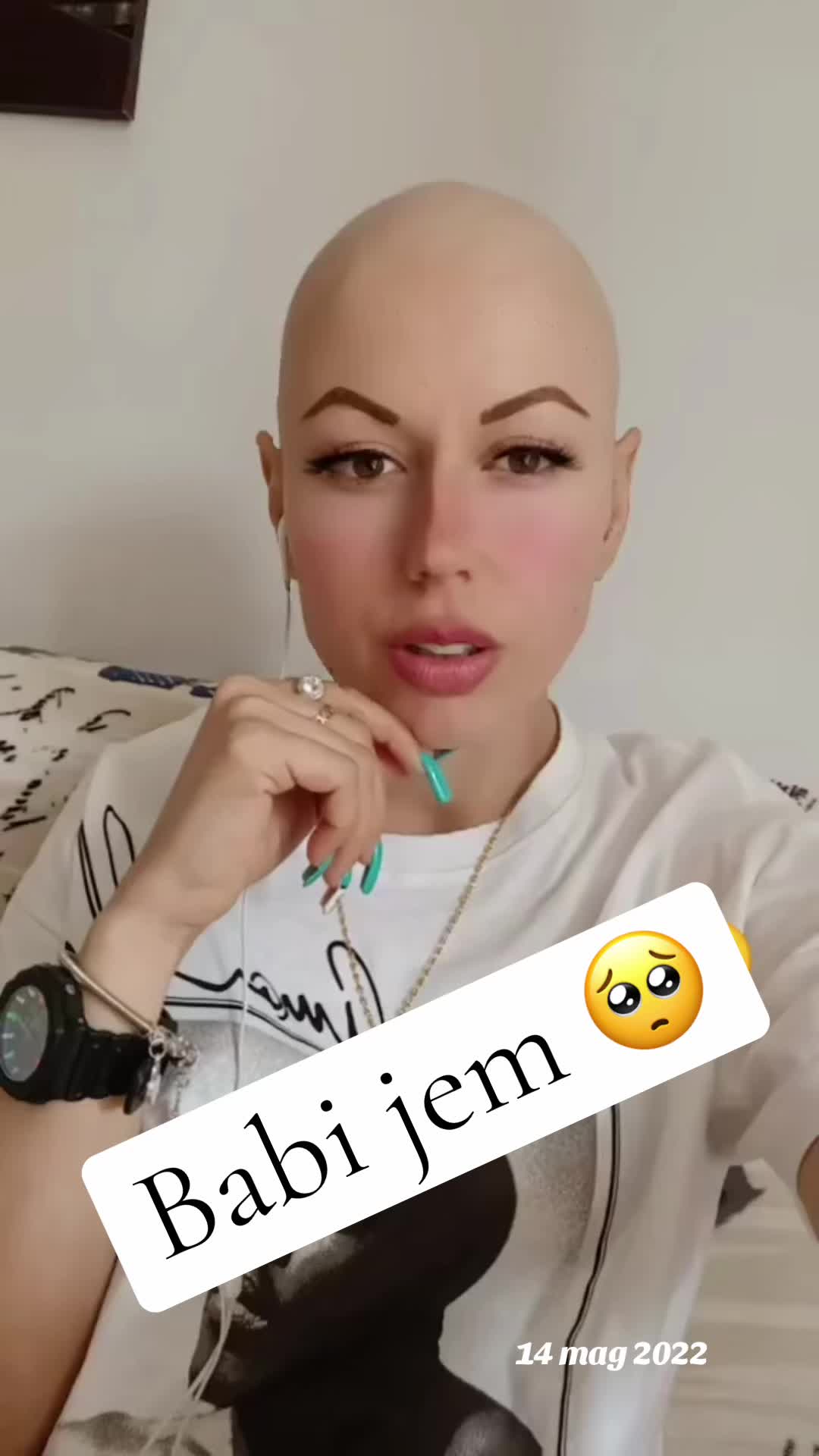 @FRANCESCA🇦🇱🇽🇰