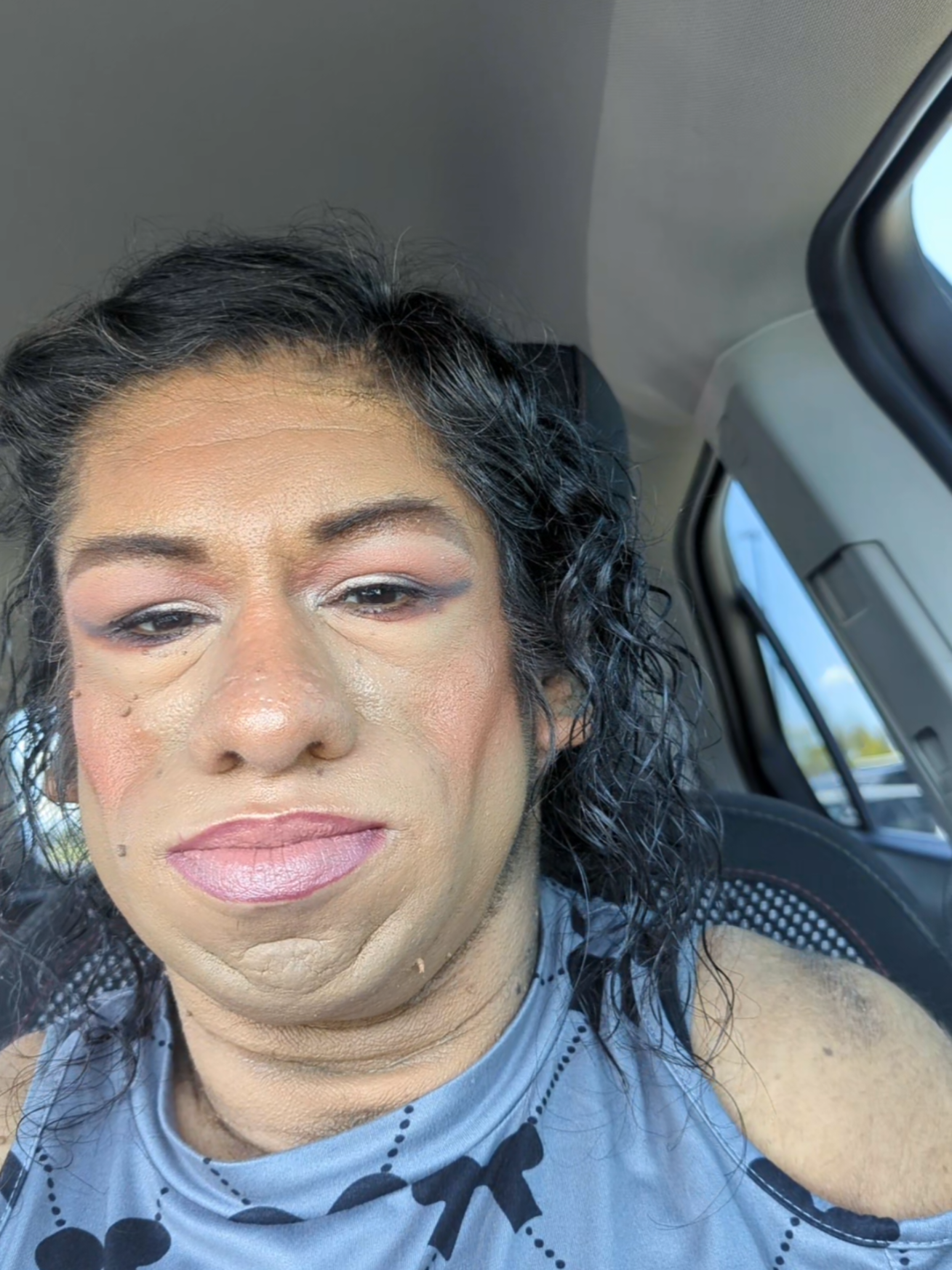 @Yessimperfections