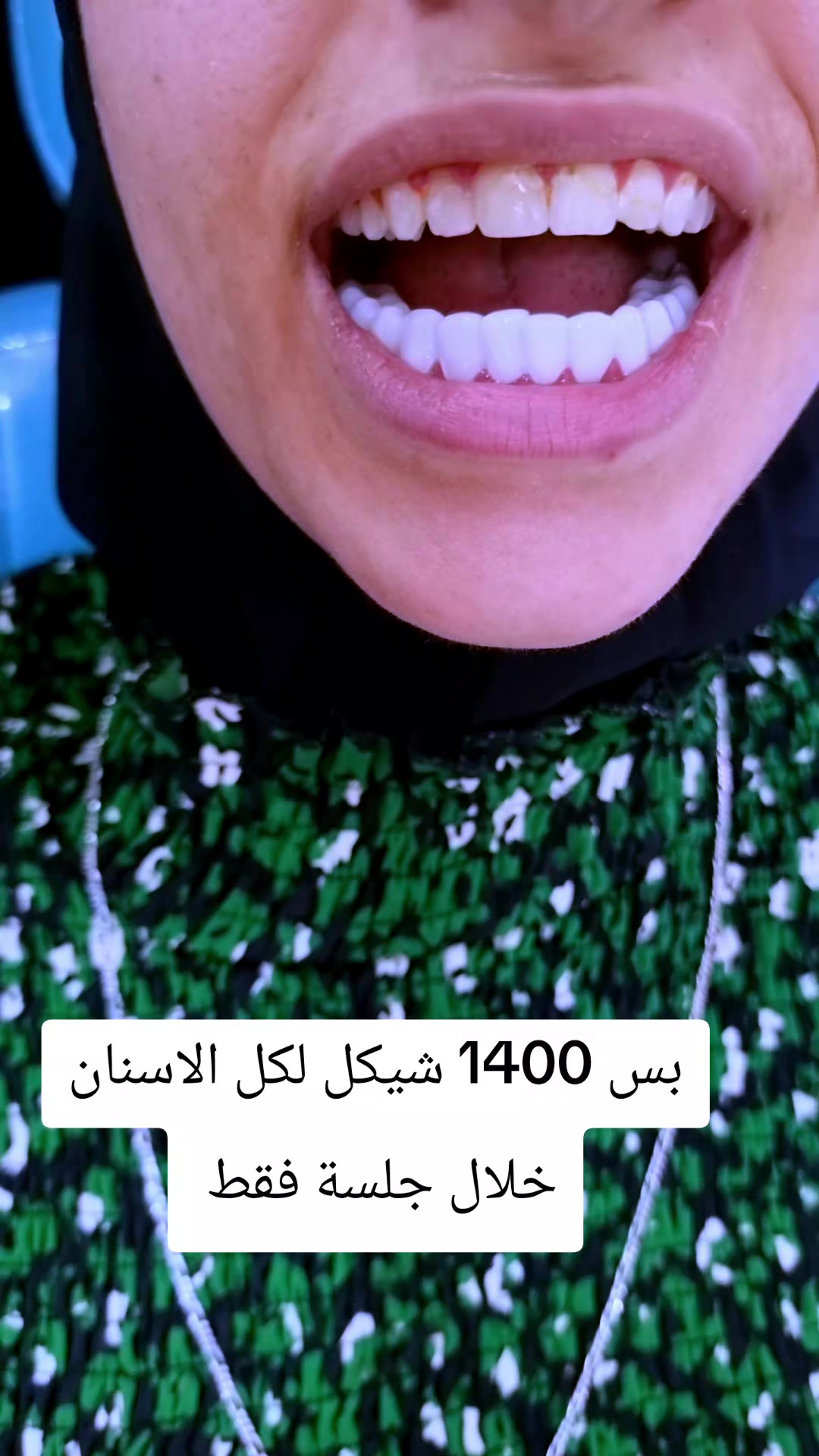 @Dr mohammad