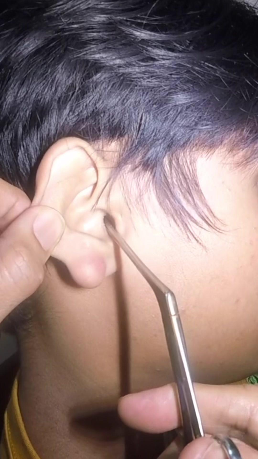 @TheEarwaxSpecialist