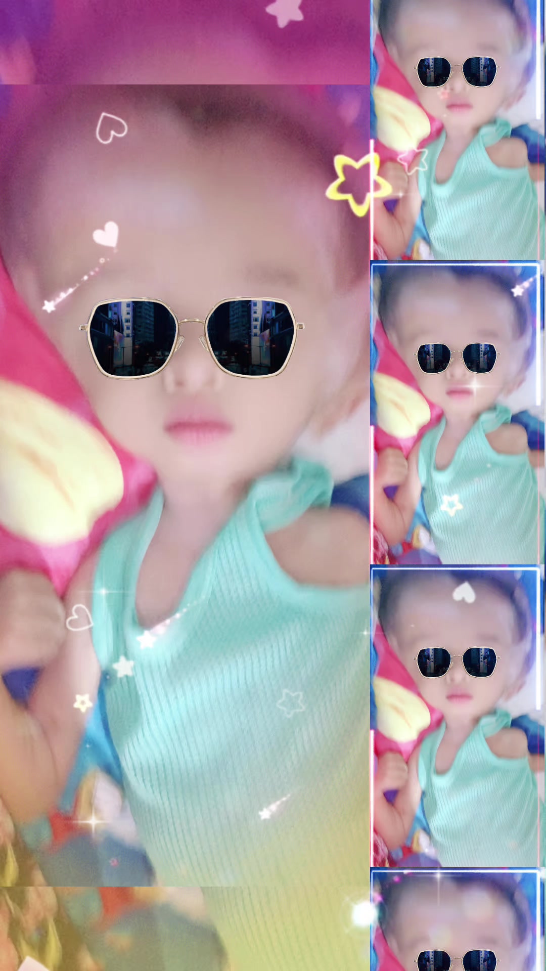 @บู้บี้เด็กหัวโตมีน้ำในโพรงสมอง
