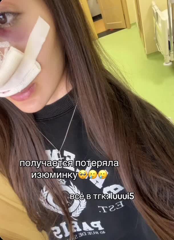 @pox_chka