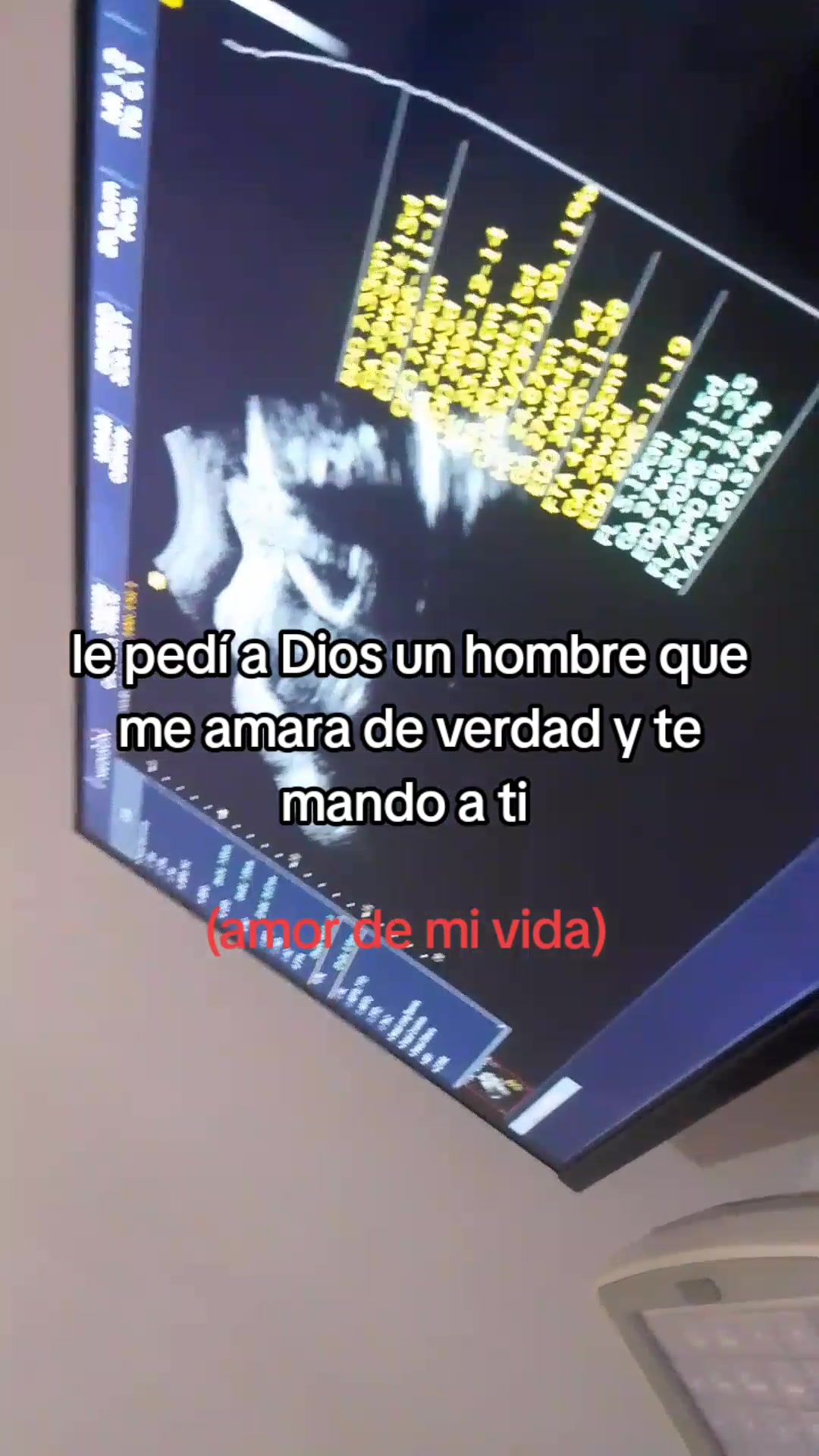 @️freilis