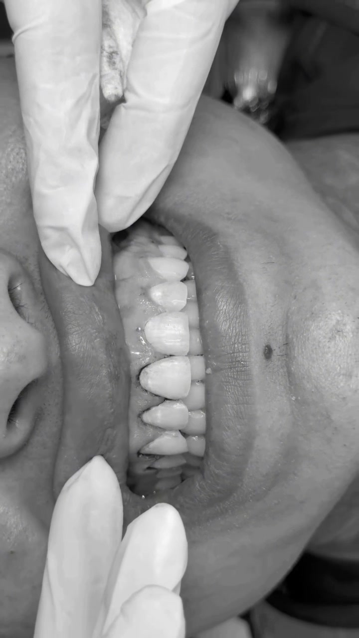 @Smiledent