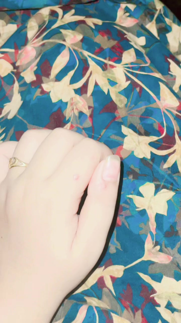 @🥀 Sana 🥀