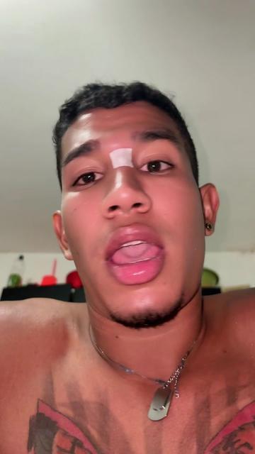 @❄️ Albert 🇻🇪🇨🇴🇲🇽Louis 🔥