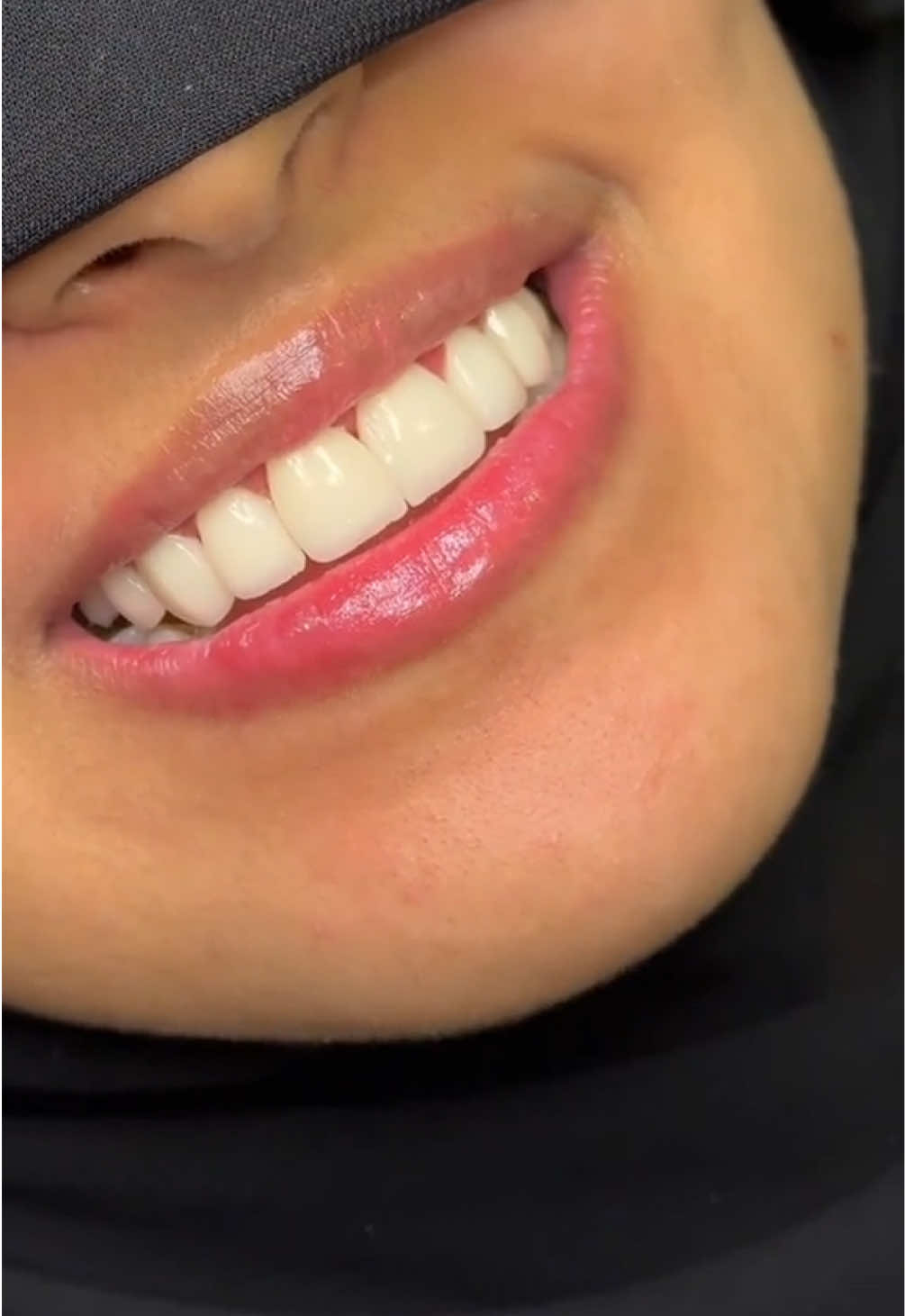 @Dr.ranaalsilani