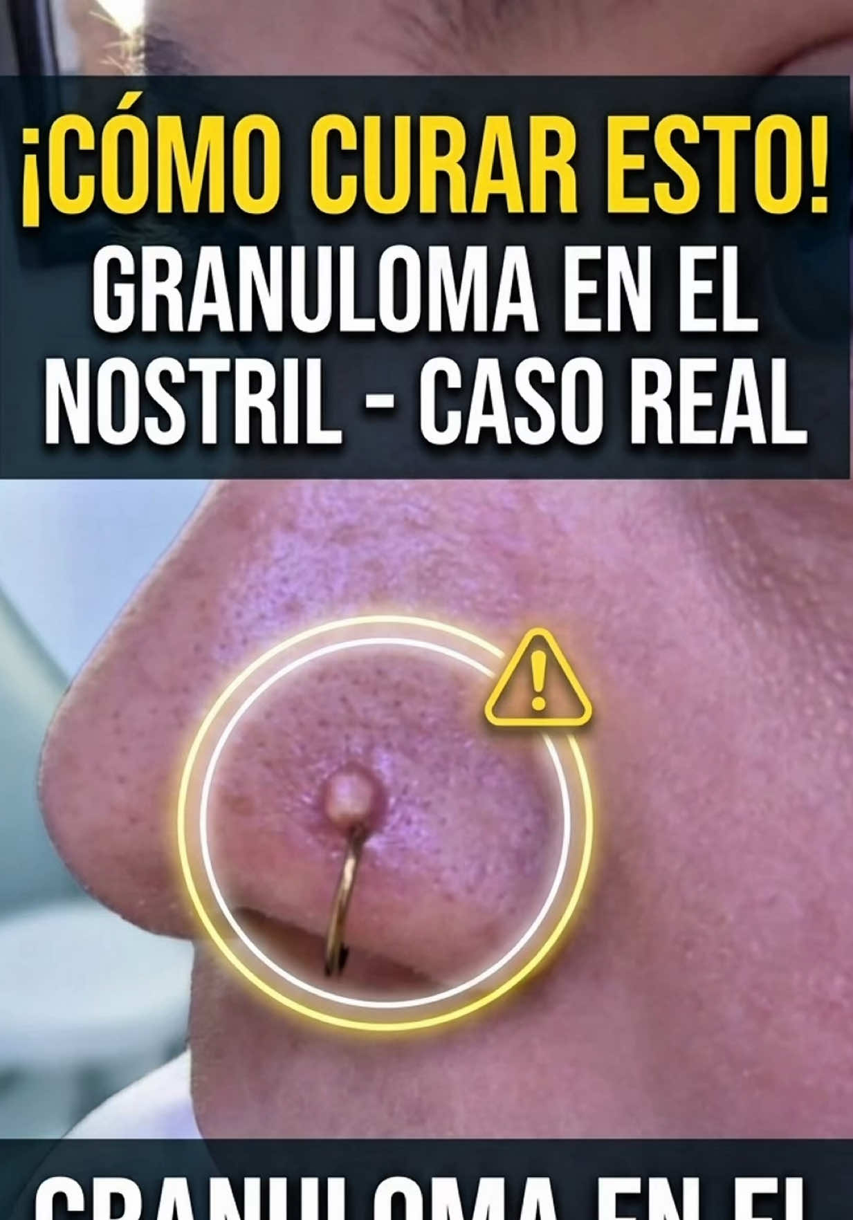 @El chico de los piercings