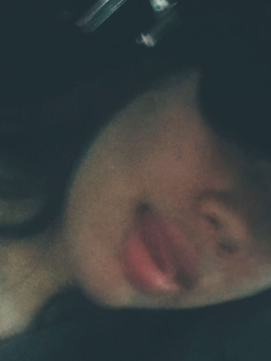 @sofix "&bull;"