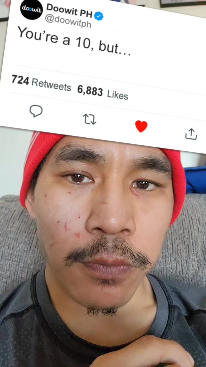 @Erwin'man666