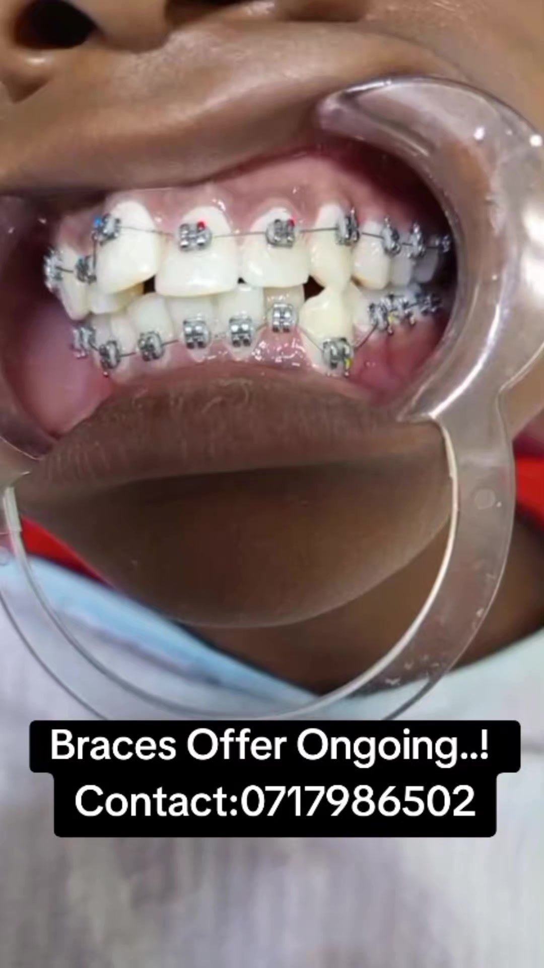 @Zabka Dental
