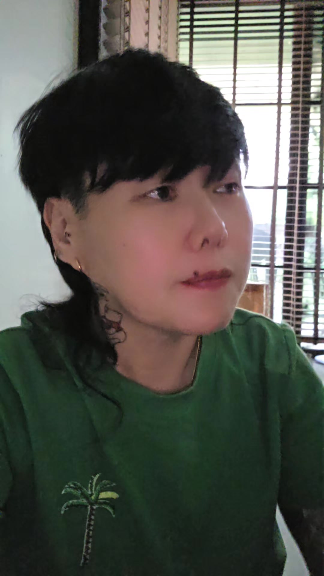 @Kei Noriel Loseo