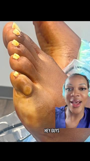 @Deniel Foot and Ankle Center