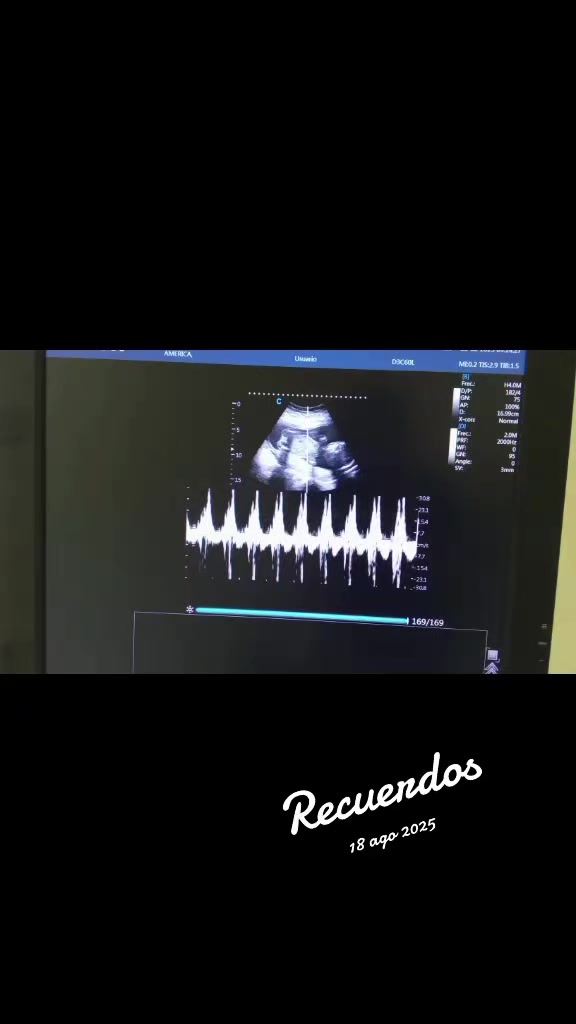 @Esther González ❤