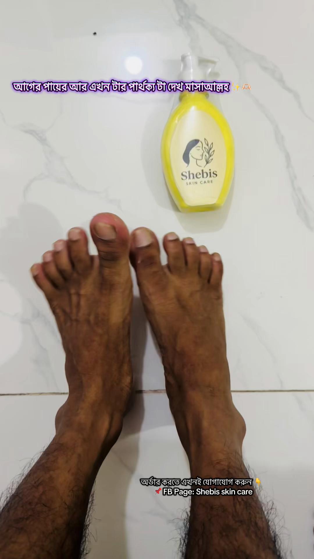 @Shebis skin care