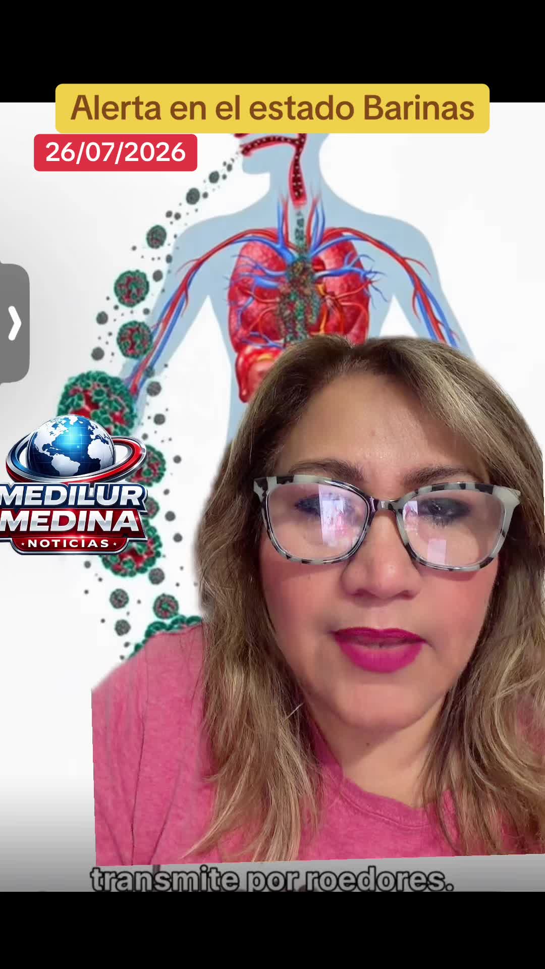 @Medilur Medina
