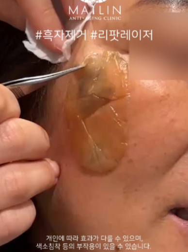 @메이린의원대구점