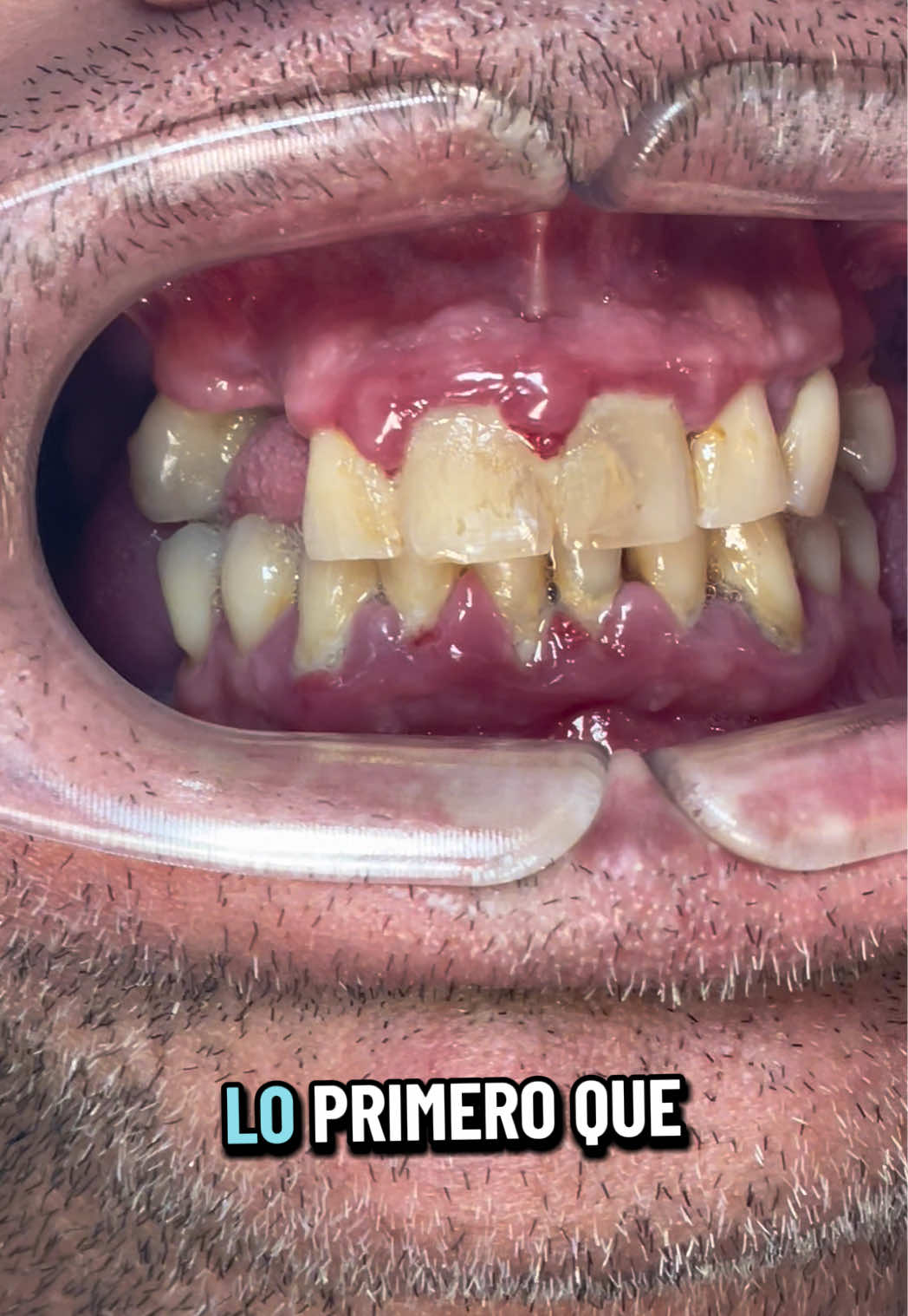 @@od.carinagonzalez