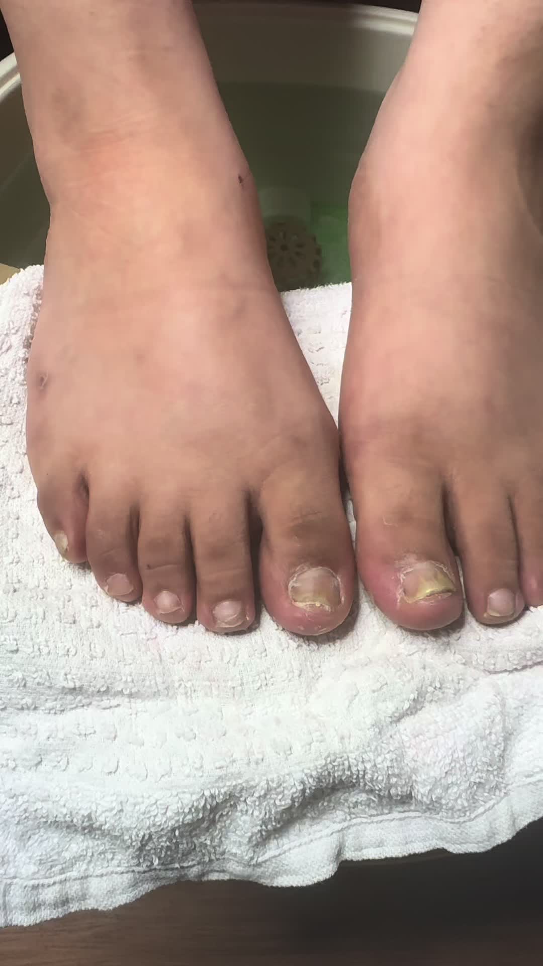 @ToesbyKoki