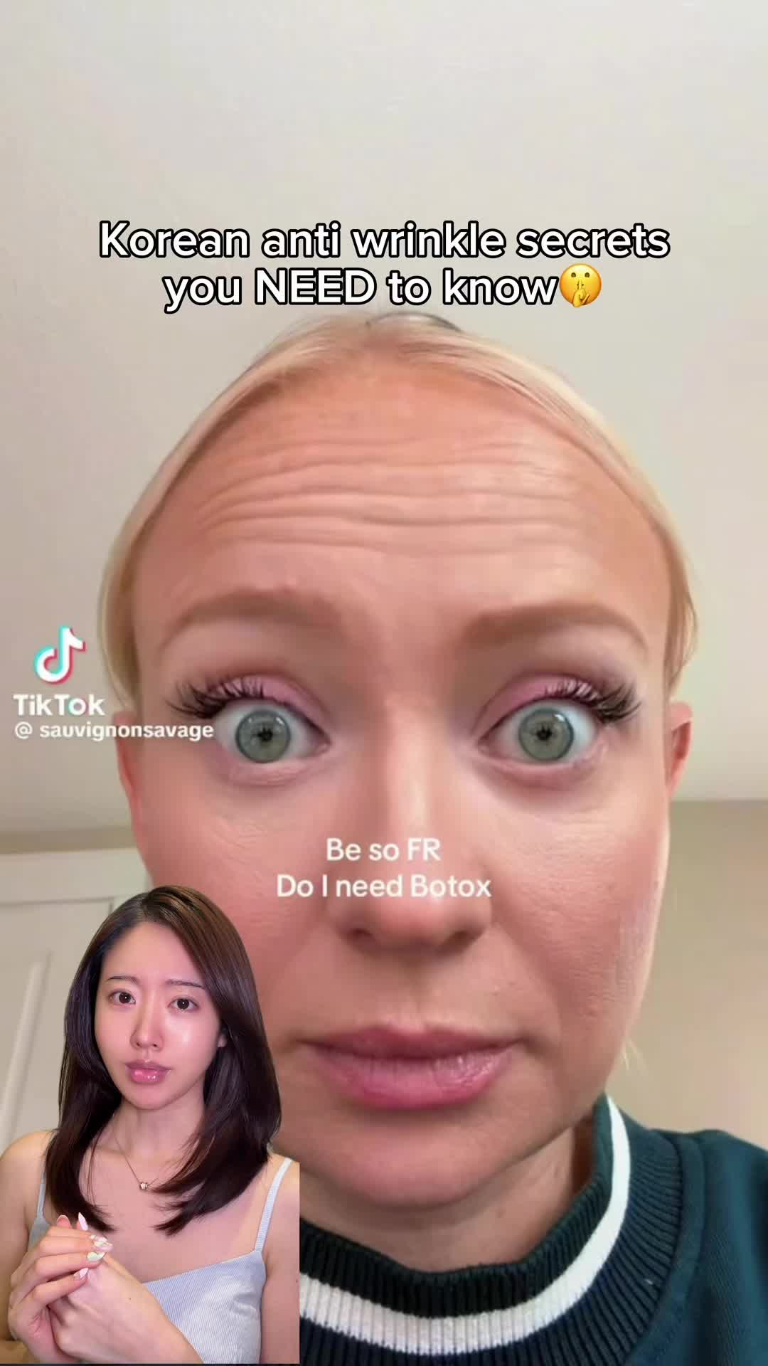@JJ