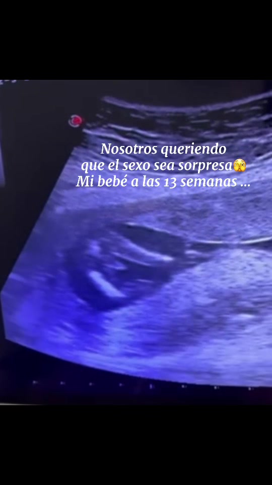 @Valeria Romero