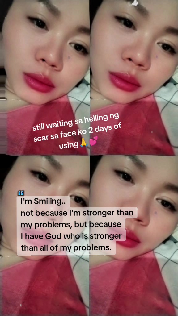 @shine