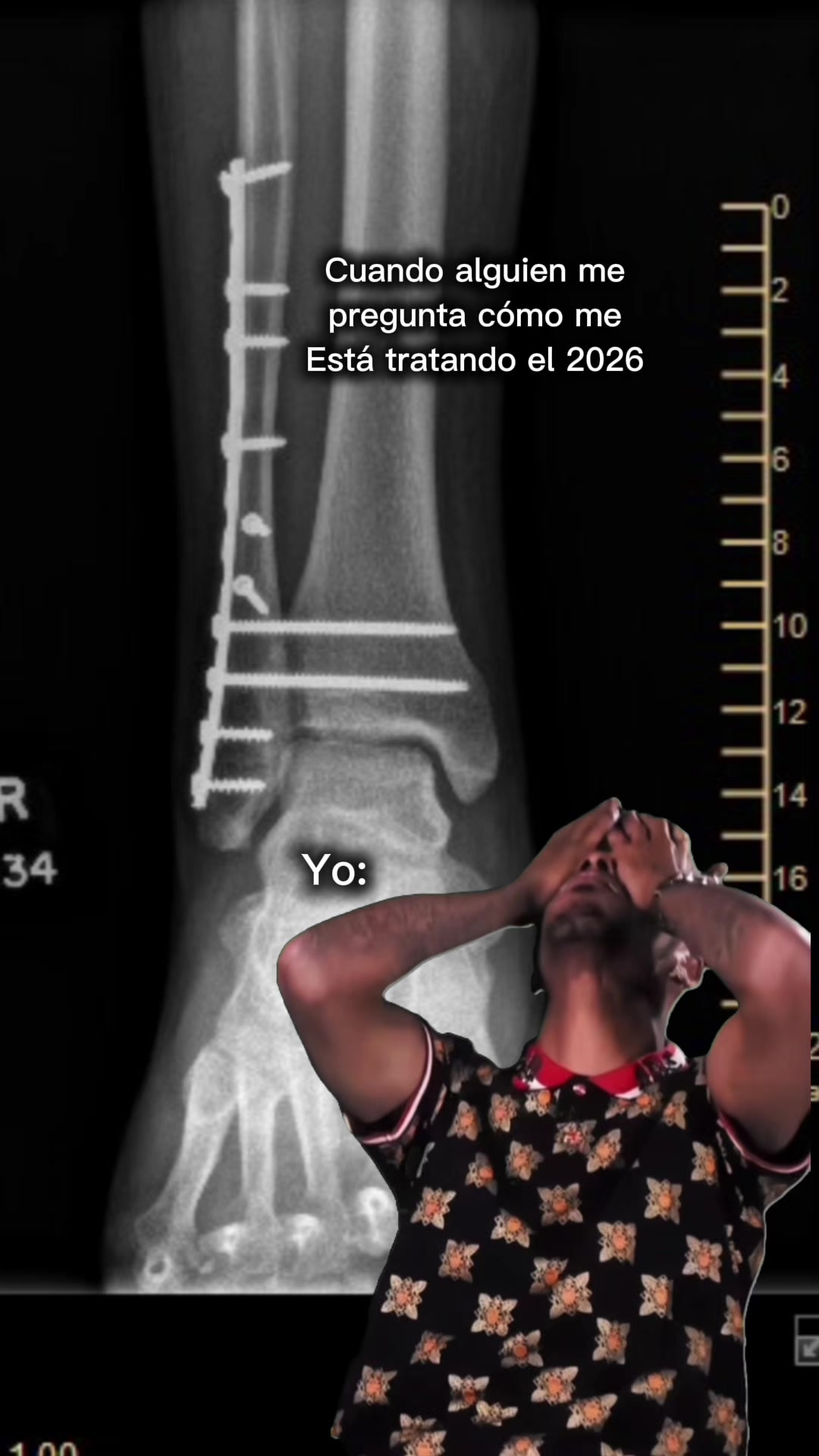 @Martín Arriaga