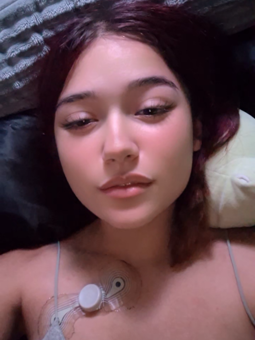 @A-M