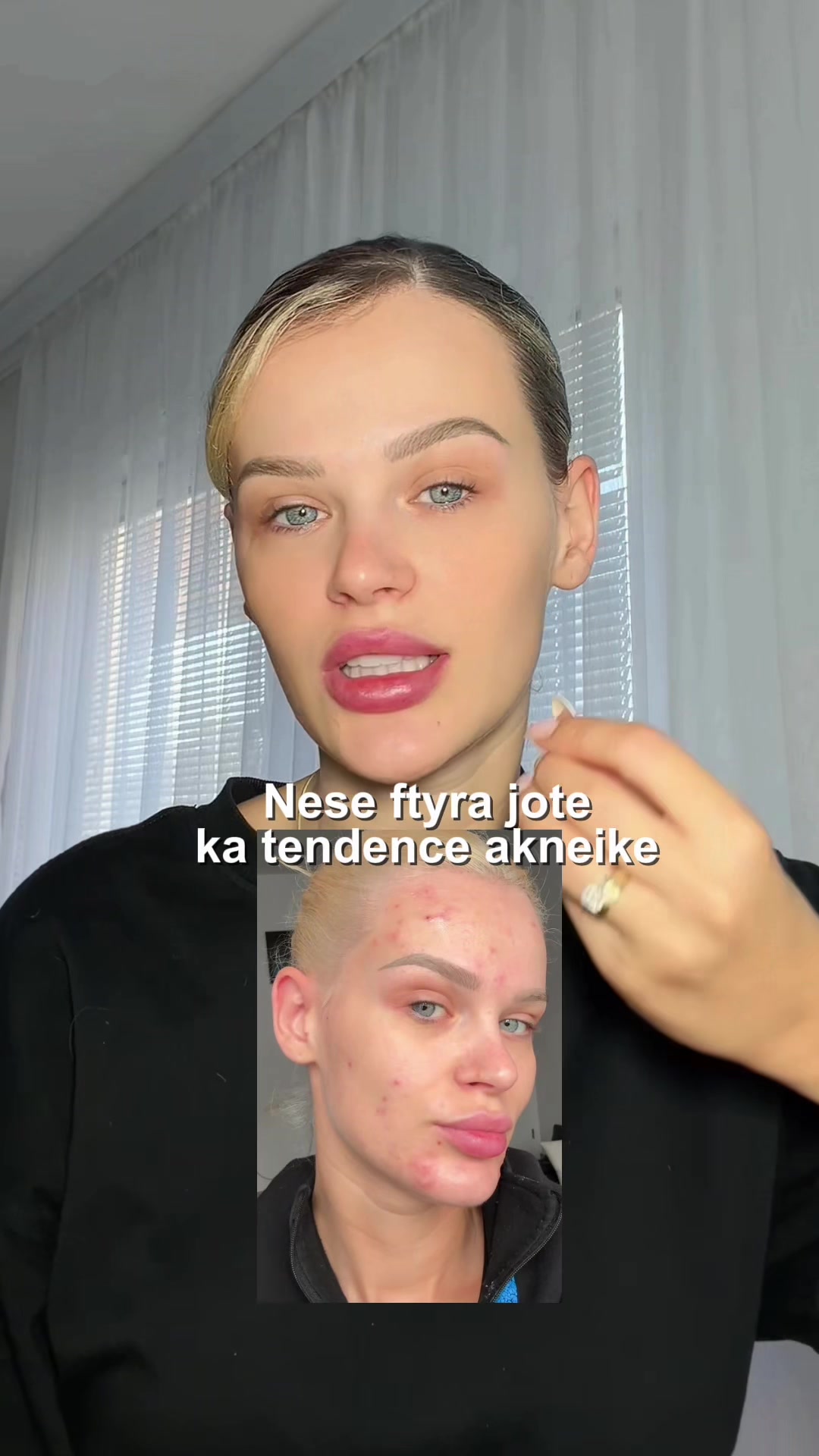 @Sparta Bojniku