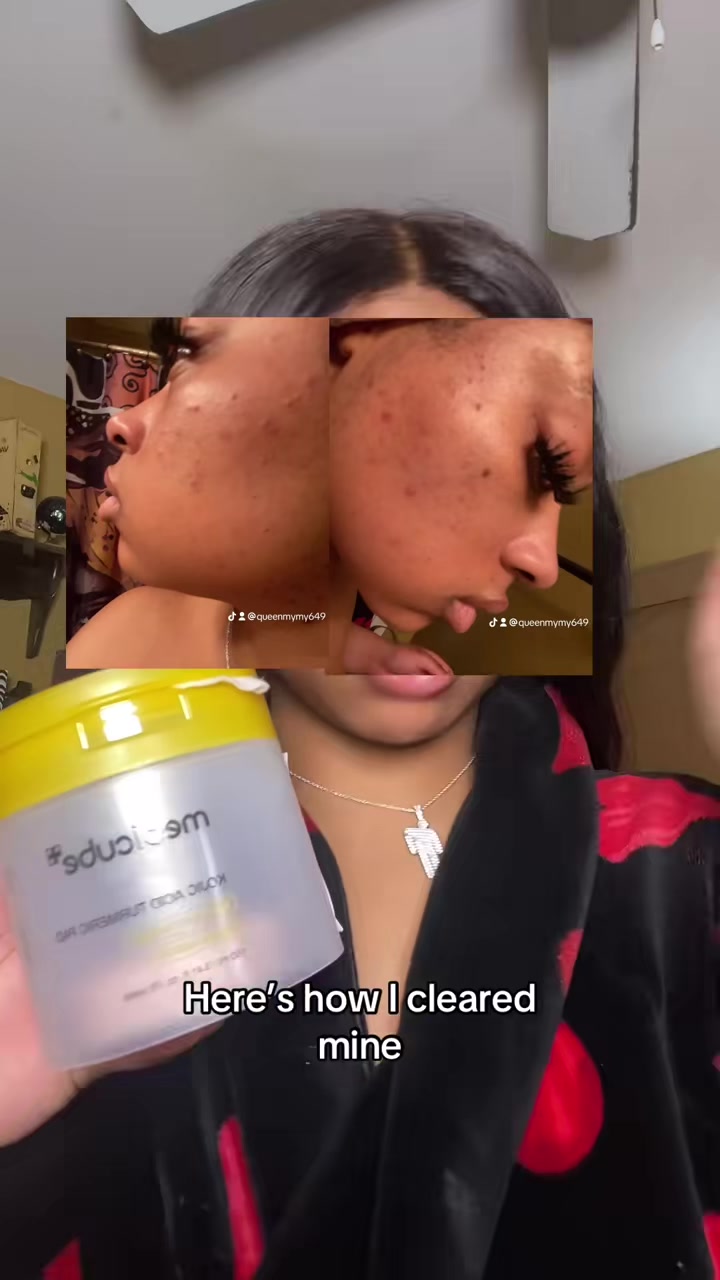 @QueenMyMy | Commentary