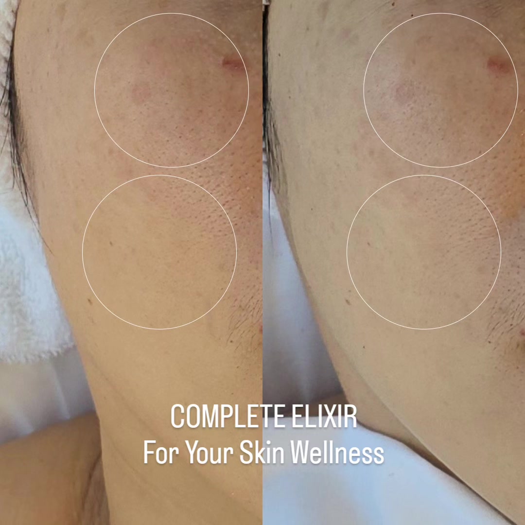 @COMPLETE ELIXIR