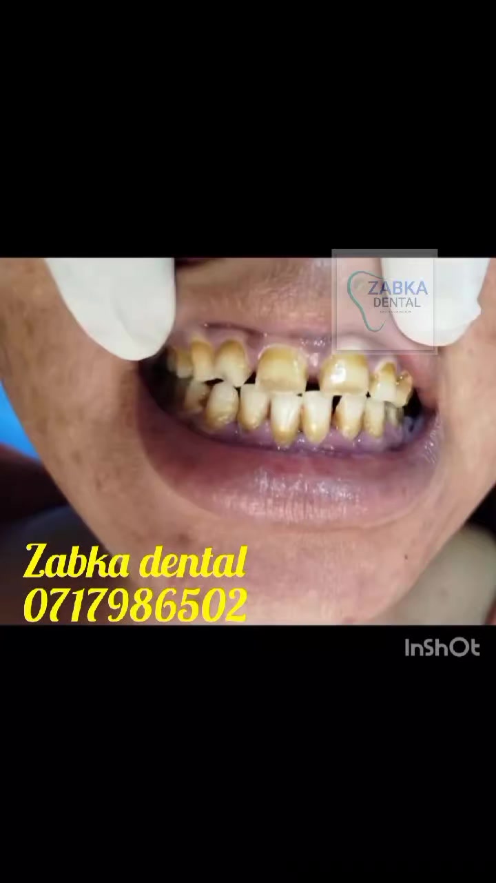 @Zabka Dental
