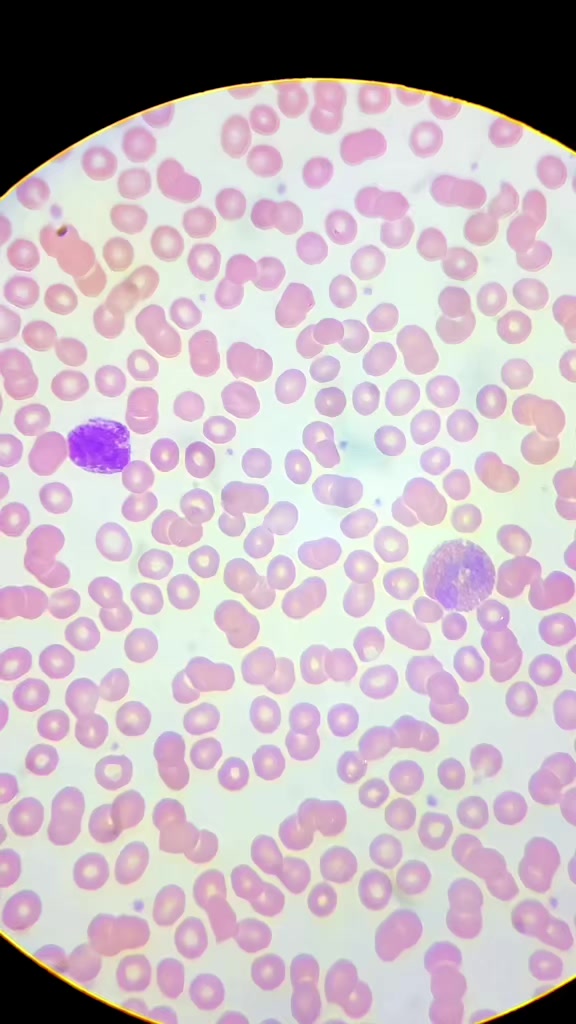 @ALab 🔬💉🩸
