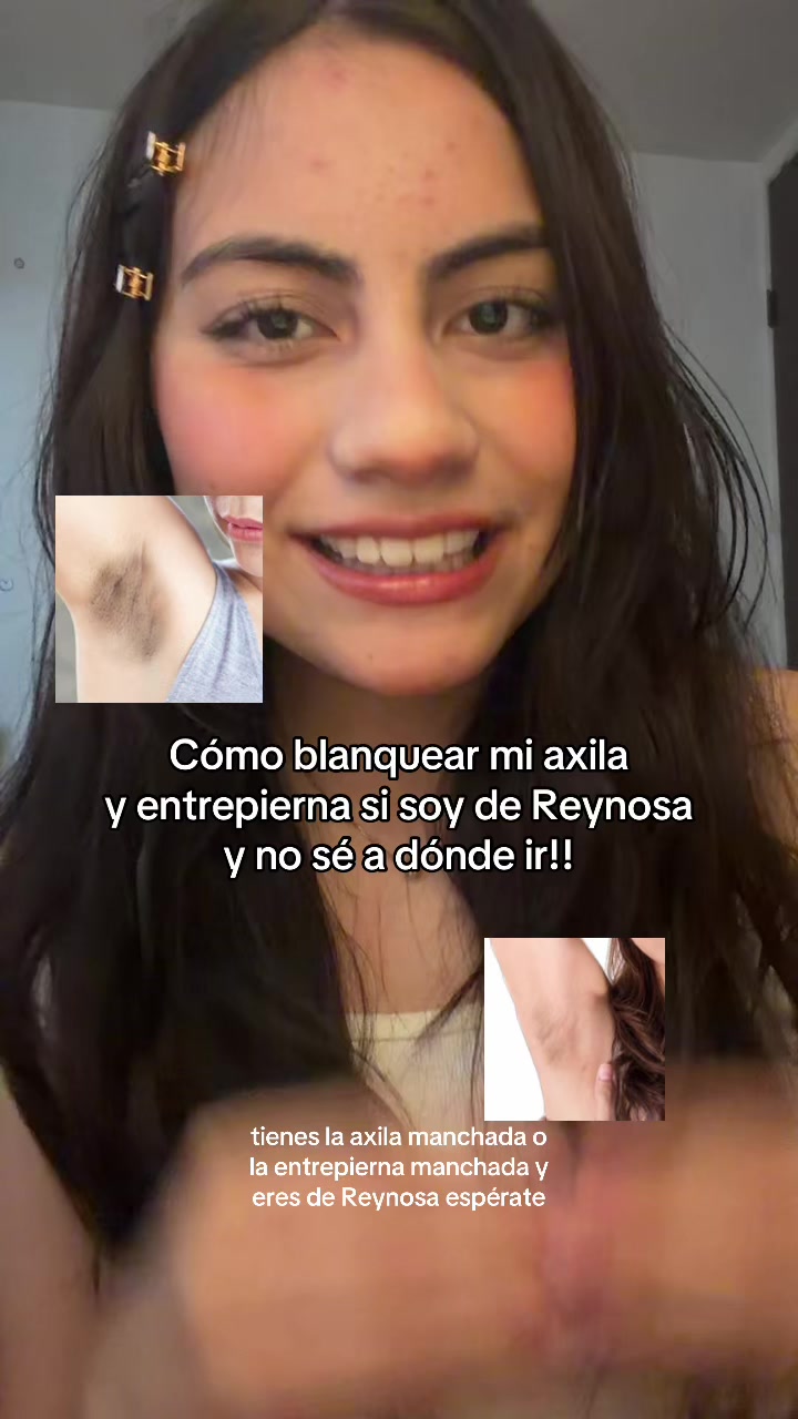 @anelis